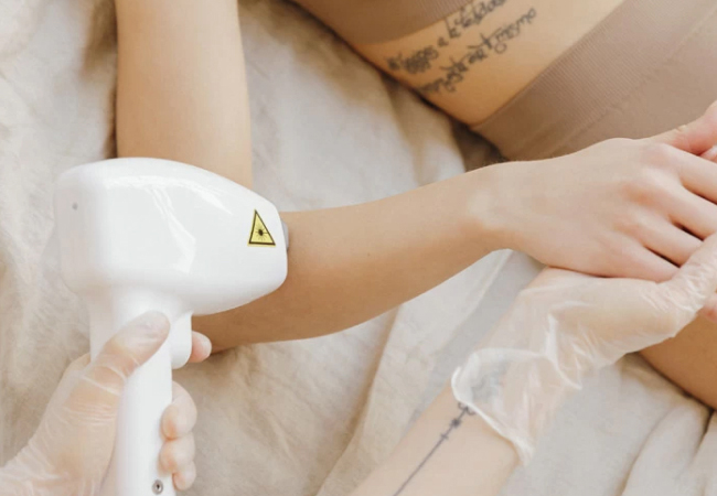 лазерная эпиляция рук цена